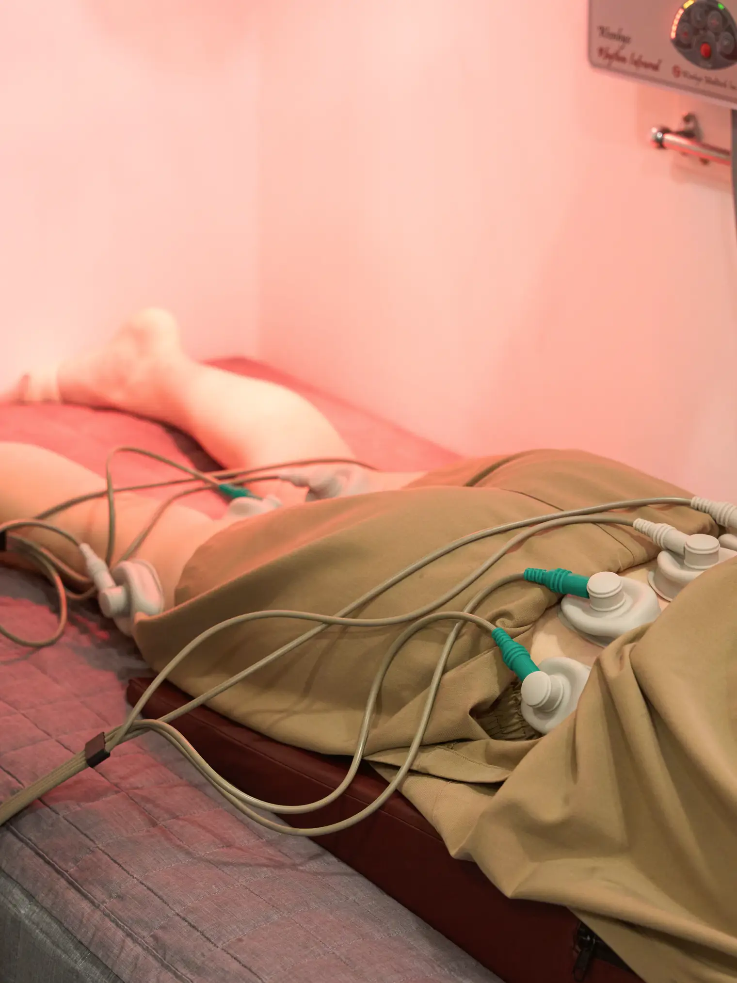 Electroacupuncture on the back under an infrared lamp