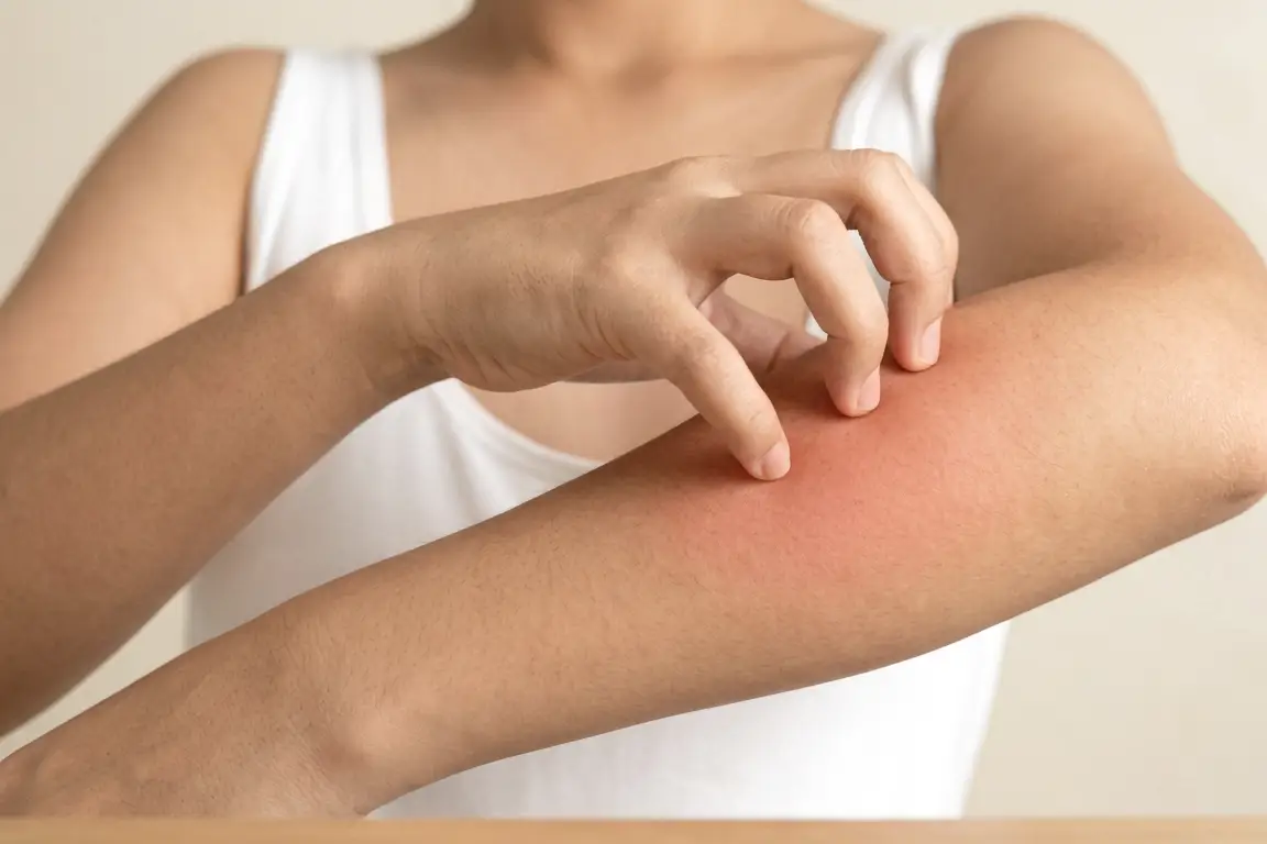 A hand scratching the reddened inside of an arm