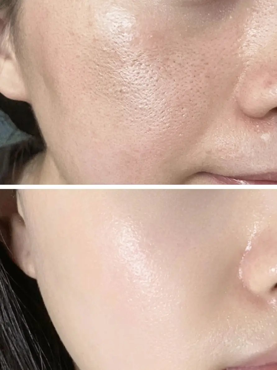 The skin texture of the same cheek area shown split into two panels, top and bottom